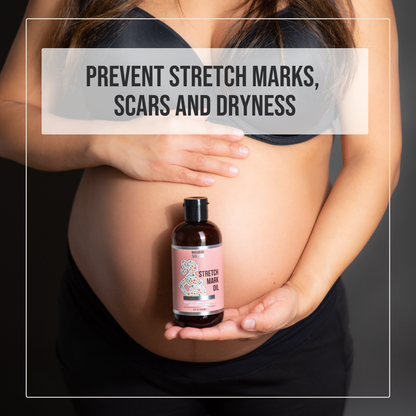 Stretch Mark Oil for Pregnancy - Cocoa Butter, Almond Oil